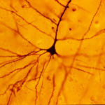 Pyramidal cell, from <a href="https://commons.wikimedia.org/wiki/File:GolgiStainedPyramidalCell.jpg">Wikimedia Commons</a>